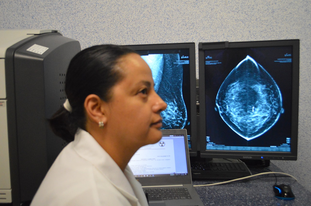 Secretaría de Salud de Guanajuato garantiza cobertura de mastografía para mujeres