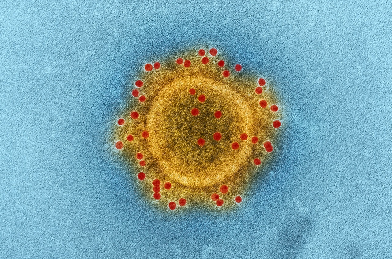 Detectan posible caso sospechoso de Coronavirus en León